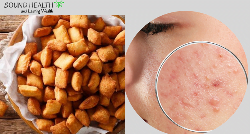 11 Incredible Side effects of Eating chin chin - Nigerian Snack