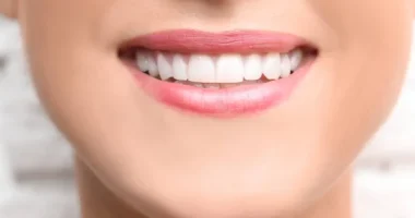 Understanding the Cosmetic Procedure of Dental Bonding In and Out