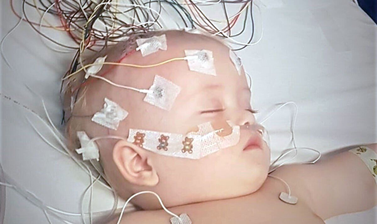 Baby suffered ‘bulging’ eyes and ‘swollen’ head due to brain tumour ...