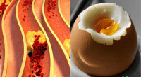 Are Eggs Bad for High Cholesterol? Separating Myth from Fact