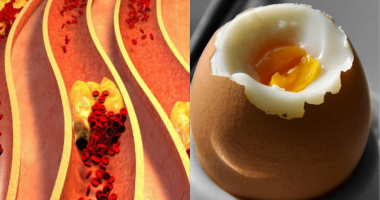 Are Eggs Bad for High Cholesterol? Separating Myth from Fact