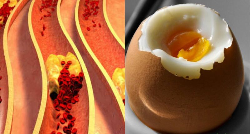 Are Eggs Bad for High Cholesterol? Separating Myth from Fact
