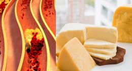 Foods to Avoid Because of High Cholesterol And What To Eat