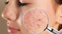 Different Types of Skin Diseases: Causes, Symptoms, and Treatment Options