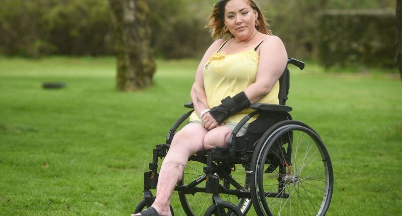 Womans Leg Amputated After Being Struck By Rare ‘flesh Eating Bug Symptoms Sound Health