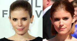 Kate Mara Nose Job And Plastic Surgery Details