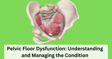 Pelvic Floor Dysfunction: Understanding and Managing the Condition