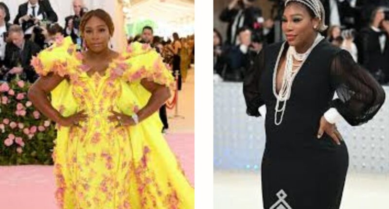Did Serena Williams Have Plastic Surgery? Face Lift And Botox Details