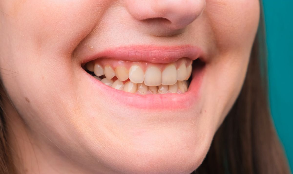 Orthodontist shares what the colour of your teeth could say about your