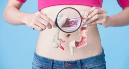 Dietary Choices Linked to Colorectal Cancer Risk: A New Study