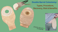 Double Barrel Colostomy: Types, Procedure, Recovery, Risk & Benefits