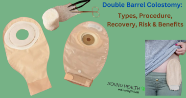 Double Barrel Colostomy: Types, Procedure, Recovery, Risk & Benefits