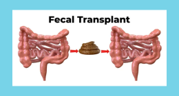 Does fecal transplant work for weight loss