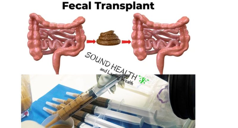 Fecal Transplant: History, Types, Procedure, Risk & Benefits