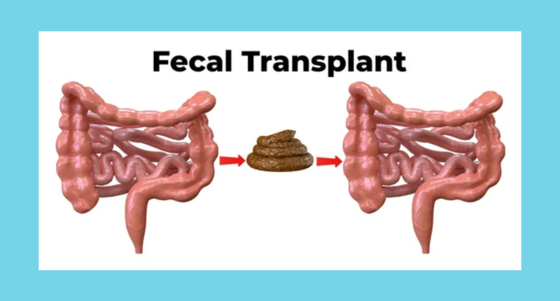 Does fecal transplant work for weight loss