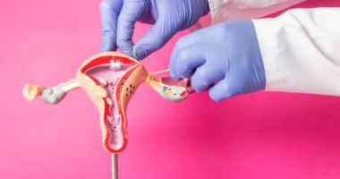 Doctors Warn About Genital Re-Shaping Surgeries