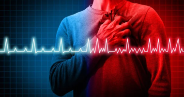 Understanding Atrial Fibrillation: What You Need to Know to Manage Your Condition