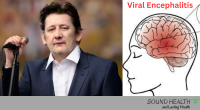 Singer Shane MacGowan Sickness Viral encephalitis: Know the Symptoms, Cause and Prevention