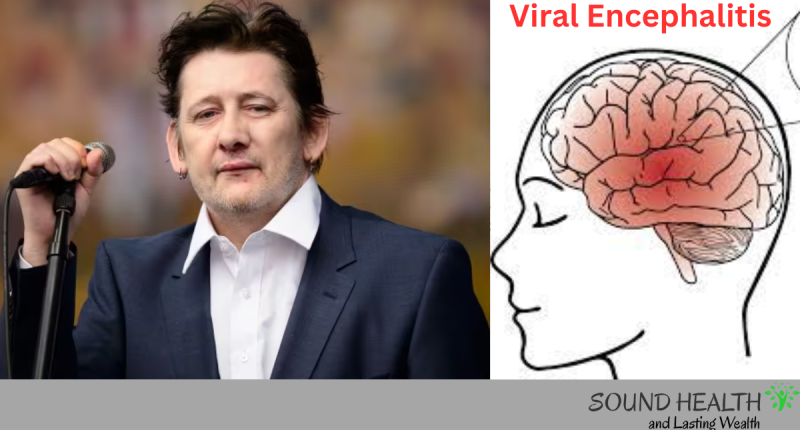 Singer Shane MacGowan Sickness Viral encephalitis: Know the Symptoms, Cause and Prevention 