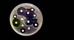 Antimicrobial Resistance Emerges as Africa's Leading Death Cause