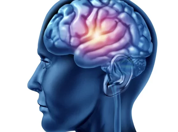 Wake Slow Waves Link to Epilepsy and Cognition - Study