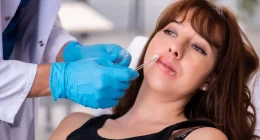 Does strong immune system impact Herpes simplex virus?