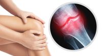 Does Joint pain and stiffness mean your body Is aging faster than you are?