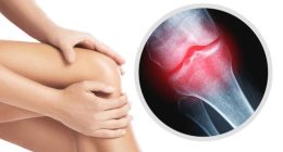 Does Joint pain and stiffness mean your body Is aging faster than you are?