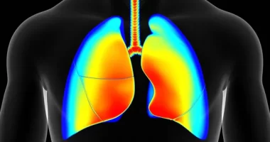 IFNγ Plays Key Role in Reducing Lung Viral Loads in COVID-19 