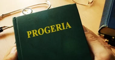 Progeria Patients Connect: Bridging the Gap for a Rare Disease Community