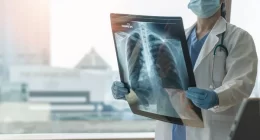 Evolution of Tuberculosis: New Insights and Facts