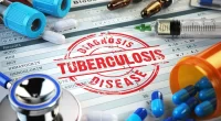 Scientists Get Funded To Study Tuberculosis Drug Development