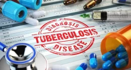 Scientists Get Funded To Study Tuberculosis Drug Development