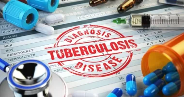 Scientists Get Funded To Study Tuberculosis Drug Development