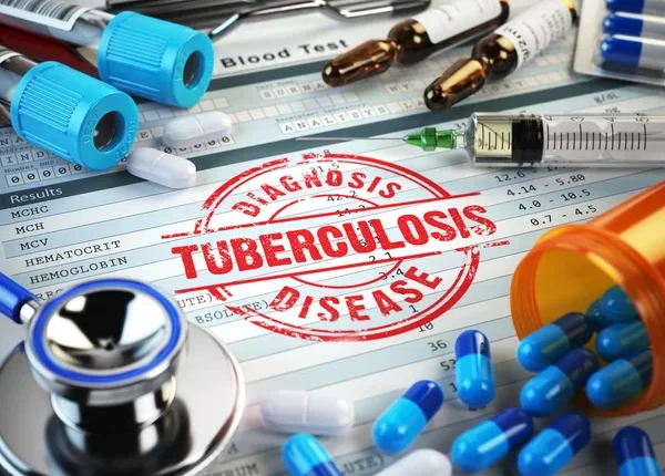 Scientists Get Funded To Study Tuberculosis Drug Development