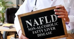 Non-alcoholic fatty liver disease