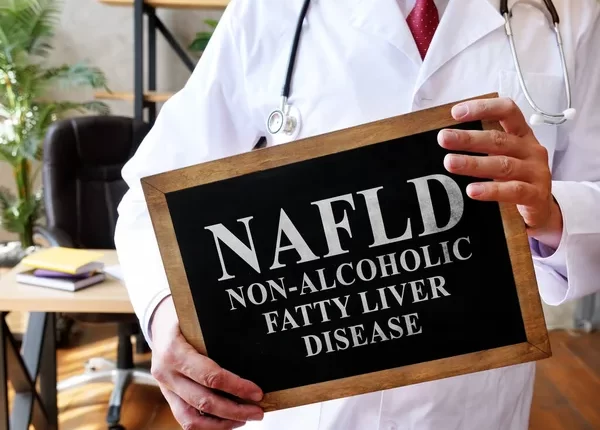 Non-alcoholic fatty liver disease