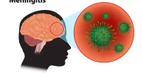 Bacterial Meningitis in Children: Lifelong Disability Looms Despite Curable Infection