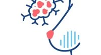 Machine Learning Predicts MS Disease Progression with 11-Protein Panel