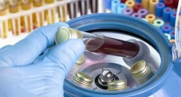 Higher viral load linked to faster HIV evolution through recombination