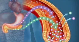 Hundreds of Genetic Markers Linked to Insulin Resistance