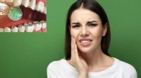 7 Effective Home Remedies For Oral Cavities That Experts Swear By