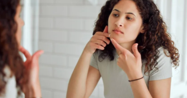 Does popping pimples cause more pimples? Fact and Myth Explored