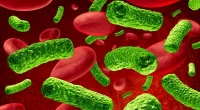 Burned patients: New blood test might spot deadly sepsis early!