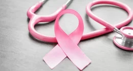 Reasons why US breast cancer mortality declined between 1975 and 2019
