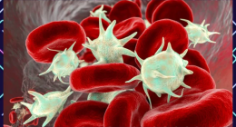 Preventing Lethal Blood Clots Naturally - No Medication