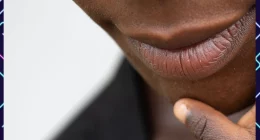 Close-up of a woman's lips with a off-white background and Dark Upper Lip