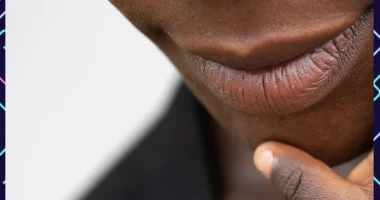 Close-up of a woman's lips with a off-white background and Dark Upper Lip