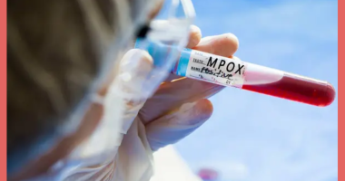 WHO Sounds Alarm as 100 New Mpox Cases Emerge in Europe Amid Soaring Deaths in Africa