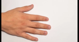 Nail Changes: What Your Fingernails Reveal About Your Health